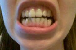 Чем больше у человека собственных зубов, тем выше его способности к запоминанию